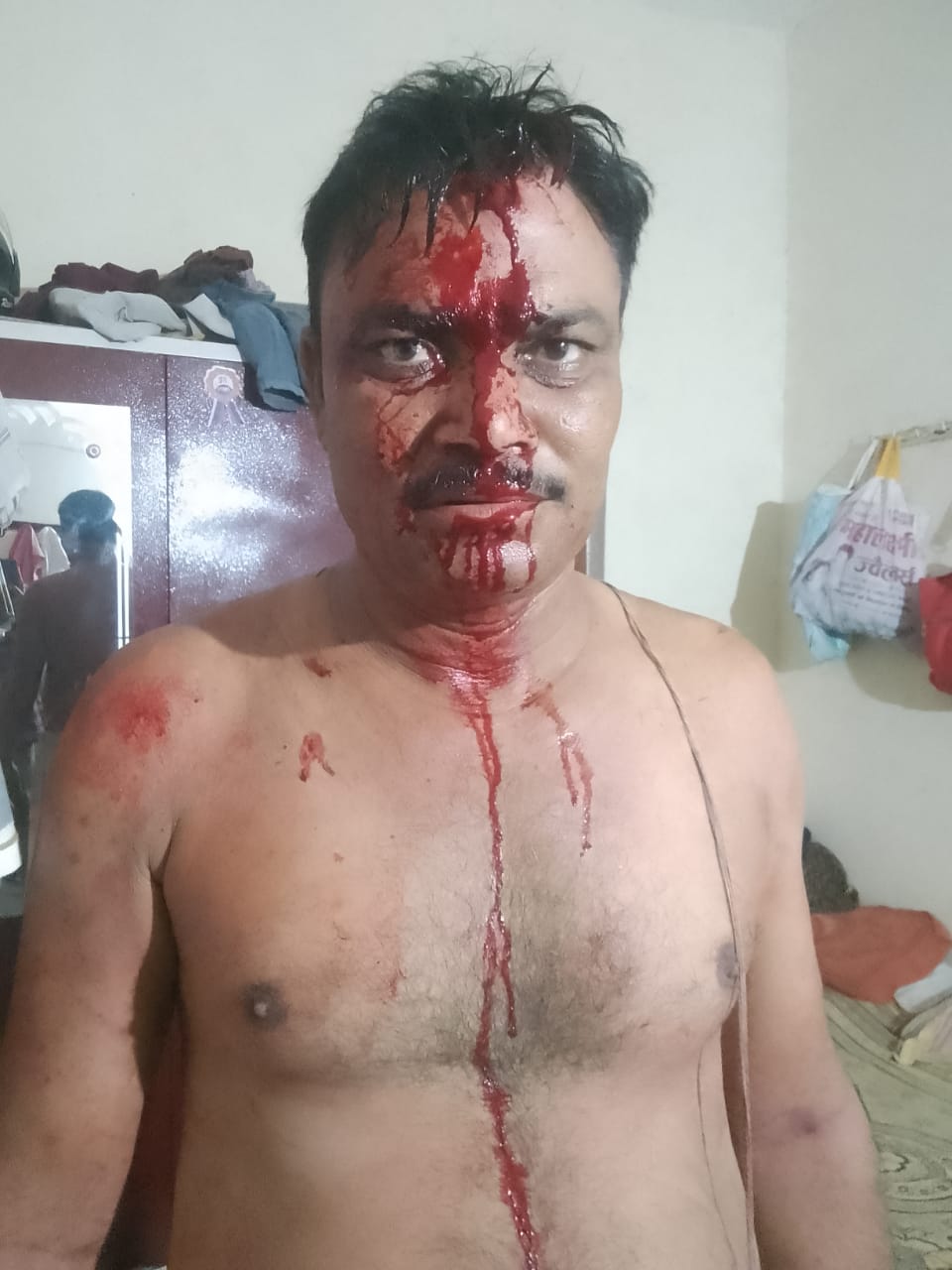 *बीच बचाव करना युवक को पड़ा भारी*