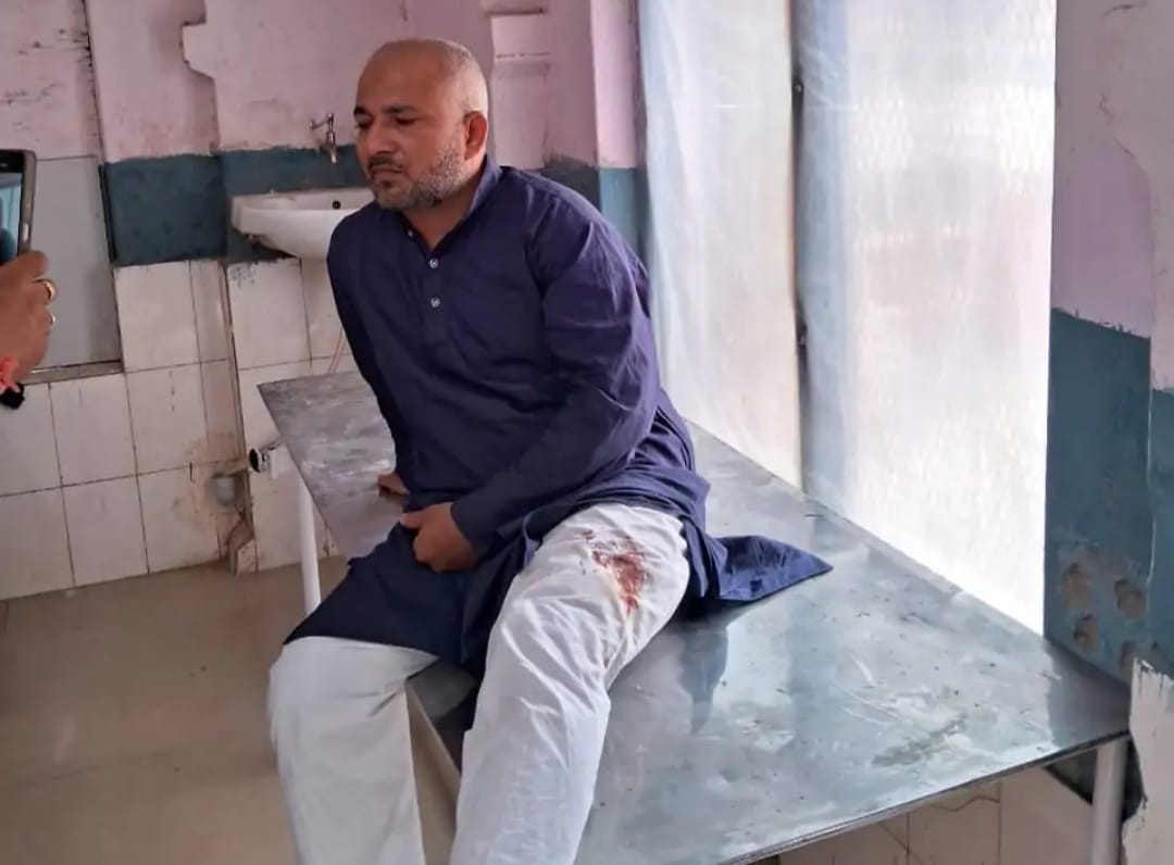 *हौंसला बुलंद बदमाशों ने दिनदहाड़े युवक को मारी गोली, लैपटॉप एवं नगदी लेकर हुए फरार*