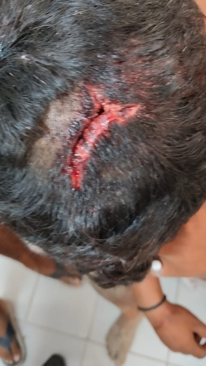 *प्रतापगढ़ थाना क्षेत्र आसपुर देवसरा बिझला गांव में जमीनी रंजिश को लेकर दो पक्षों में जमकर हुई मारपीट*