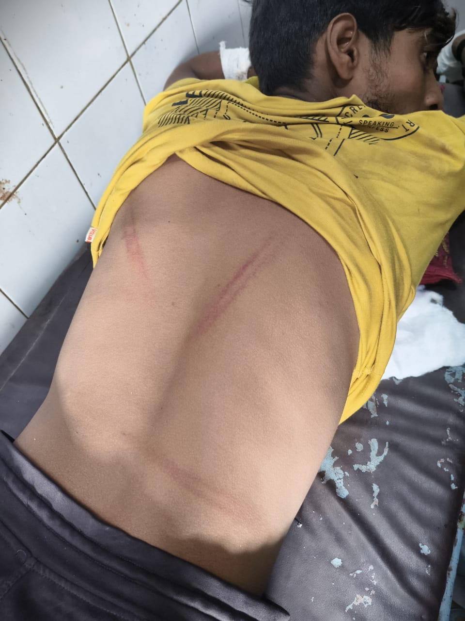 प्रतापगढ पट्टी कोतवाली के अंतर्गत दलित युवक पर जानलेवा हमला दी जान से मारने की धमकी