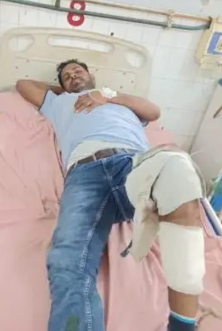 त्रिलोचन बाजार में मुठभेड़, वांछित बदमाश अखिलेश यादव उर्फ नेता घायल