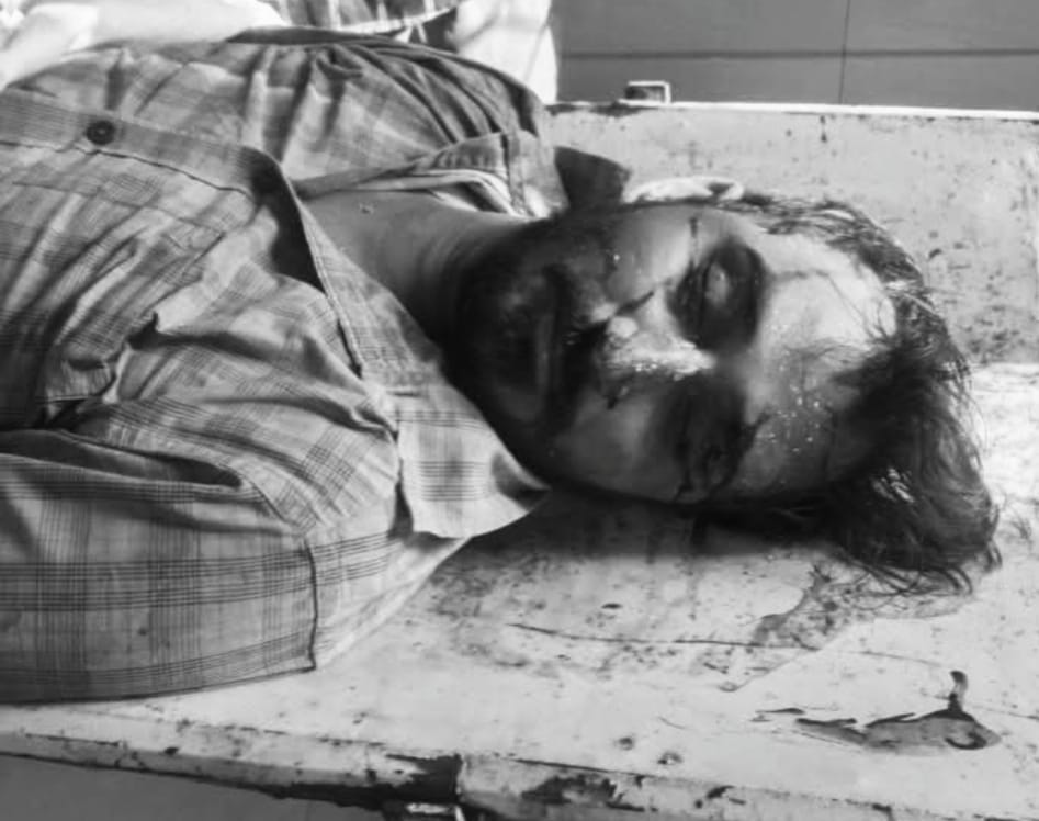 लखनऊ मार्ग पर भीषण सड़क हादसा, घनश्यामपुर निवासी प्रदीप तिवारी की मौत, दो घायल