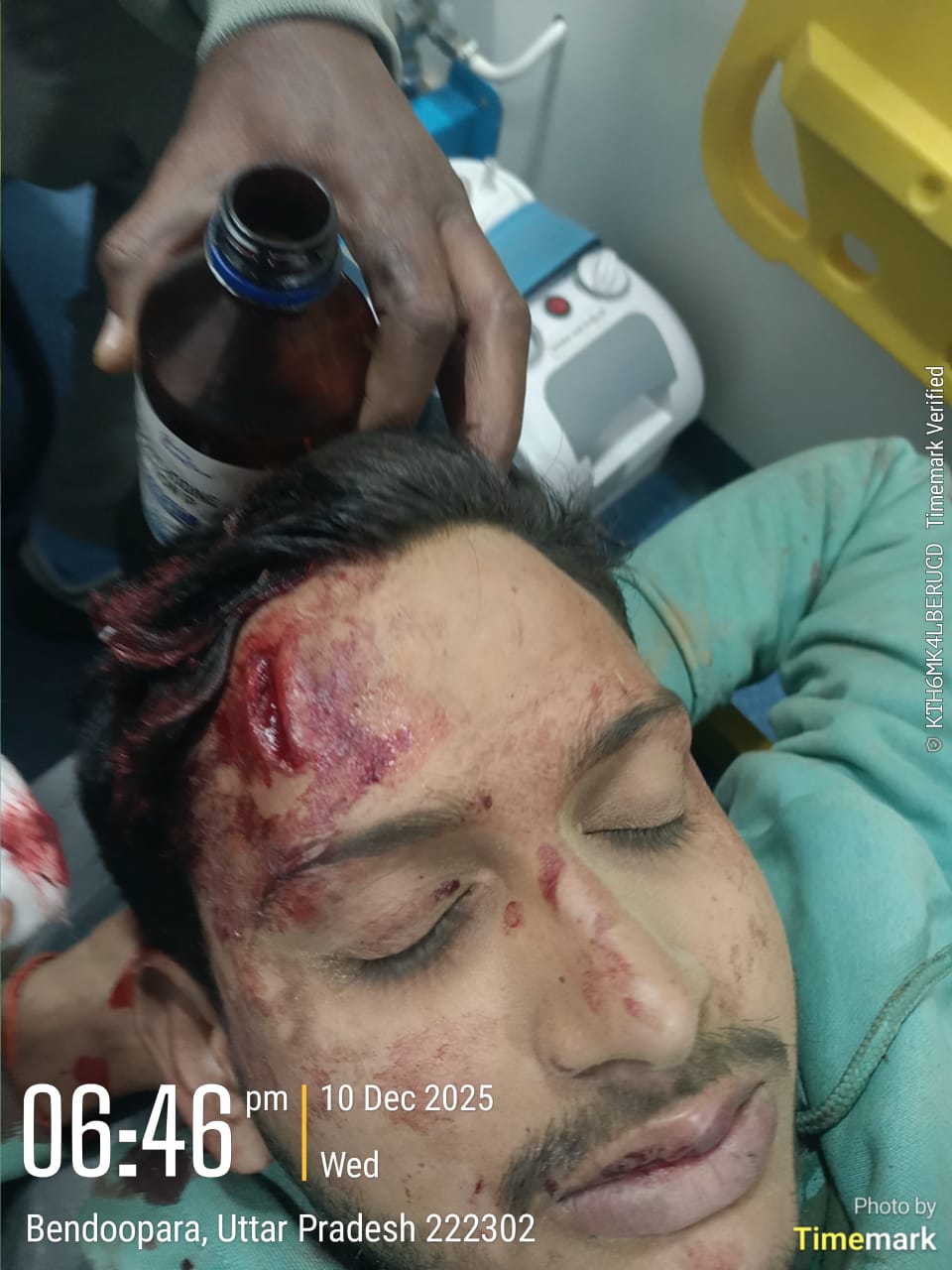 देर साम लम्भुआ के बेदूपारा बाईपास पर अनियंत्रित टेंकर से बड़ा होते होते टला